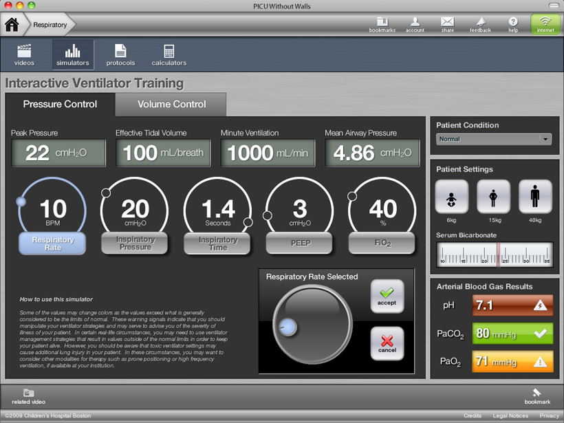 PICU Ventilator